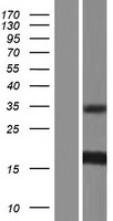 ISCU Human Over-expression Lysates NM_014301