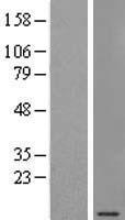 SEC61G Human Over-expression Lysates NM_001012456