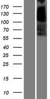 CES3 Human Over-expression Lysates NM_024922