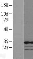 CBX7 Human Over-expression Lysates NM_175709