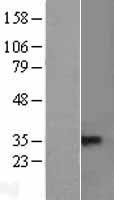 TACI (TNFRSF13B) Human Over-expression Lysates NM_012452