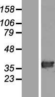 HAAO Human Over-expression Lysates NM_012205