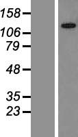 ls023506 kiaa0240 gltscr1l human over expression lysates nm 015349 wb testing 1