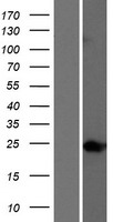 TTC9 Human Over-expression Lysates NM_015351