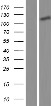 MORC3 Human Over-expression Lysates NM_015358