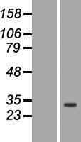 ls023520 anp32c human over expression lysates nm 012403 wb testing 1