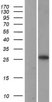 RPL13A Human Over-expression Lysates NM_012423