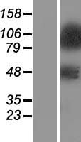 ZNF281 Human Over-expression Lysates NM_012482