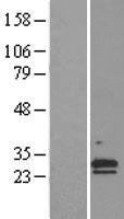 NNT1 (CLCF1) Human Over-expression Lysates NM_013246