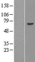PRAME Human Over-expression Lysates NM_006115