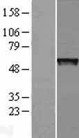 PRAME Human Over-expression Lysates NM_206953