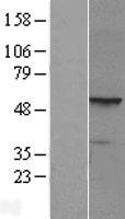 ls023532 prame human over expression lysates nm 206956 wb testing 5