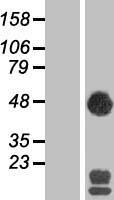 SEC14 like protein 2 (SEC14L2) Human Over-expression Lysates NM_012429