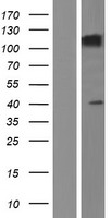 SEZ6L Human Over-expression Lysates NM_001184776