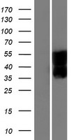 SEZ6L Human Over-expression Lysates NM_021115