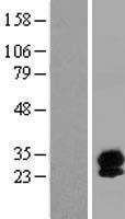 Synaptogyrin 4 (SYNGR4) Human Over-expression Lysates NM_012451