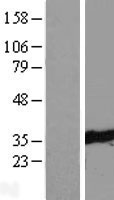 TTC33 Human Over-expression Lysates NM_012382