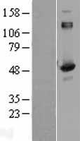 Aspartyl Aminopeptidase (DNPEP) Human Over-expression Lysates NM_012100