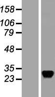 ls023551 rasd2 human over expression lysates nm 014310 wb testing 1