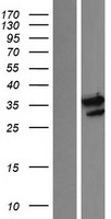 CCRK (CDK20) Human Over-expression Lysates NM_012119