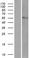 ls023553 hyal4 human over expression lysates nm 012269 wb testing 1