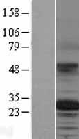 TSPAN12 Human Over-expression Lysates NM_012338