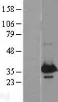 WBP2 Human Over-expression Lysates NM_012478
