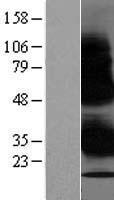 ls023559 wbp1 human over expression lysates nm 012477 wb testing 1