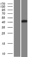 CHST5 Human Over-expression Lysates NM_024533