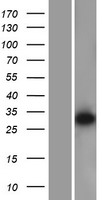 DDAH2 Human Over-expression Lysates NM_013974