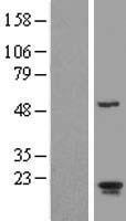 ls023568 arl2bp human over expression lysates nm 012106 wb testing 1