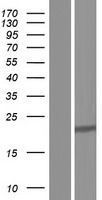DDAH1 Human Over-expression Lysates NM_001134445