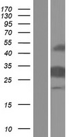 Caspase 14 (CASP14) Human Over-expression Lysates NM_012114