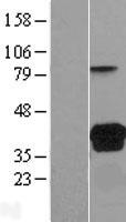ls023584 vsig2 human over expression lysates nm 014312 wb testing 1