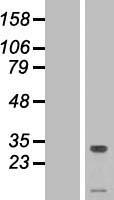 TMEM50A Human Over-expression Lysates NM_014313