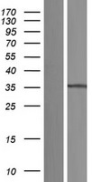 C17orf81 (ELP5) Human Over-expression Lysates NM_203413