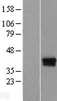 ls023587 c17orf81 elp5 human over expression lysates nm 203415 wb testing 4