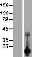 CARHSP1 Human Over-expression Lysates NM_014316