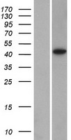 DPS1 (PDSS1) Human Over-expression Lysates NM_014317