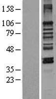 MAN1 (LEMD3) Human Over-expression Lysates NM_014319