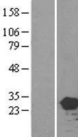 HEBP2 Human Over-expression Lysates NM_014320