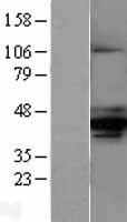 AMACR Human Over-expression Lysates NM_014324