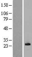 CLEC5A Human Over-expression Lysates NM_013252