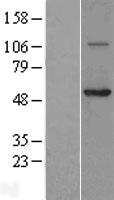 Coronin 3 (CORO1C) Human Over-expression Lysates NM_014325