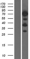 CD2AP Human Over-expression Lysates NM_012120