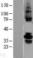 TSSK2 Human Over-expression Lysates NM_053006