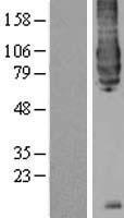 BACE1 Human Over-expression Lysates NM_012104
