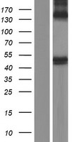 BACE1 Human Over-expression Lysates NM_138971