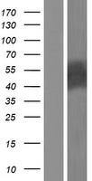 Cbl c (CBLC) Human Over-expression Lysates NM_001130852