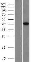 SPO11 Human Over-expression Lysates NM_198265